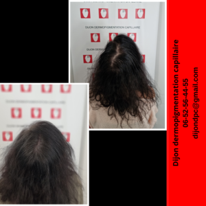 Densification capillaire