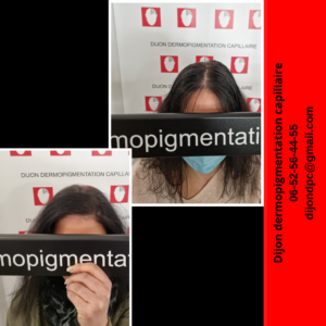 Densification capillaire