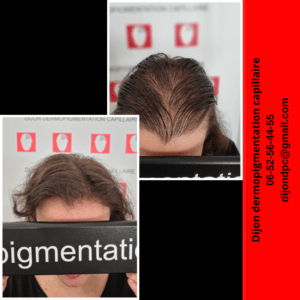 Densification capillaire