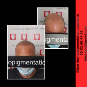 Effet rasé: ligne naturelle